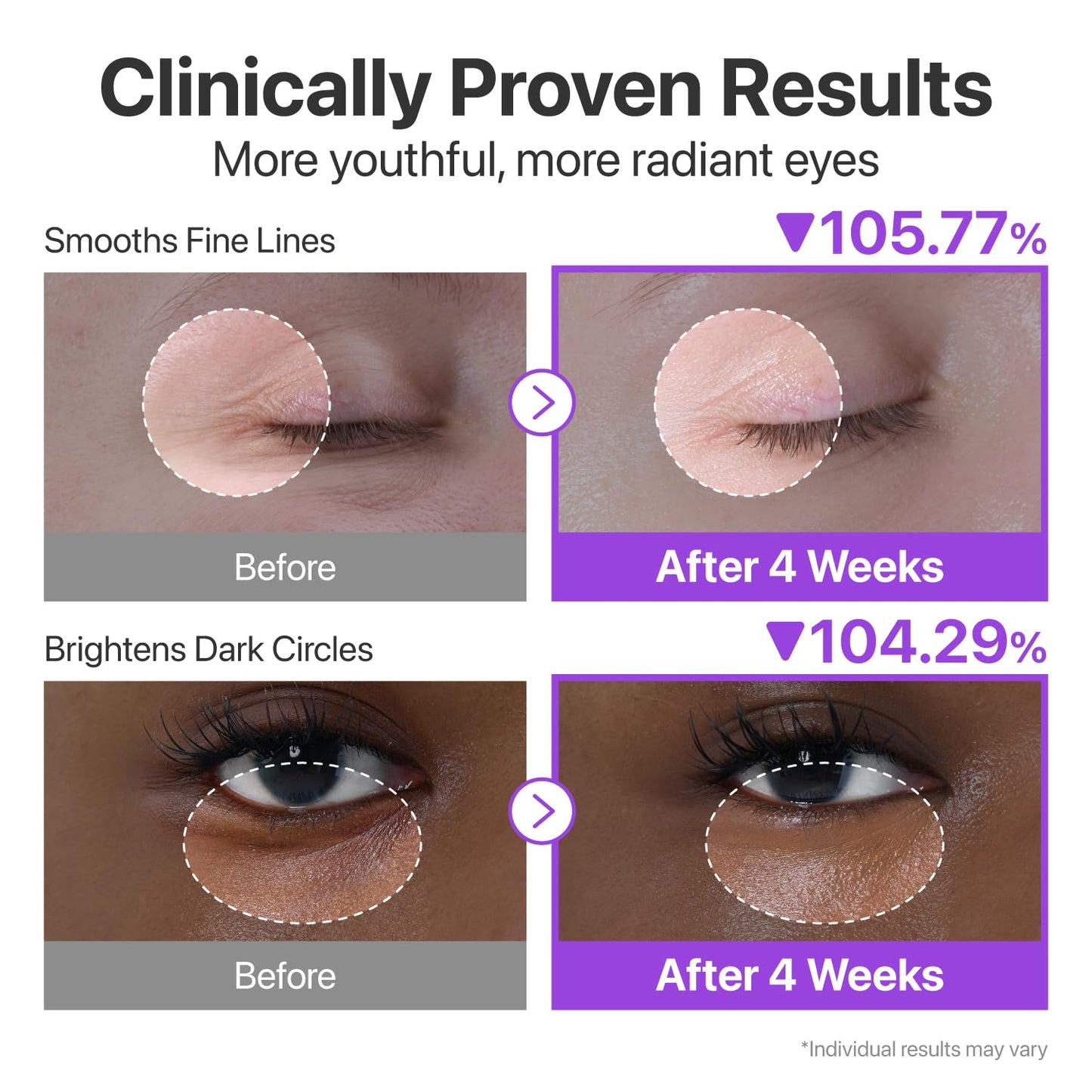 NUSKIN™ Korean NAD+ Retinol Eye Cream