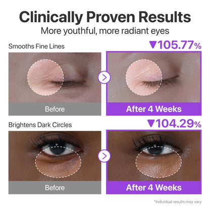 NUSKIN™ Korean NAD+ Retinol Eye Cream