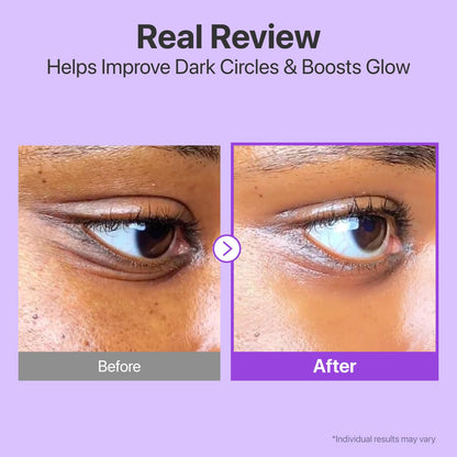 NUSKIN™ Korean NAD+ Retinol Eye Cream