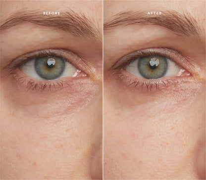 NUSKIN™ Korean NAD+ Retinol Eye Cream